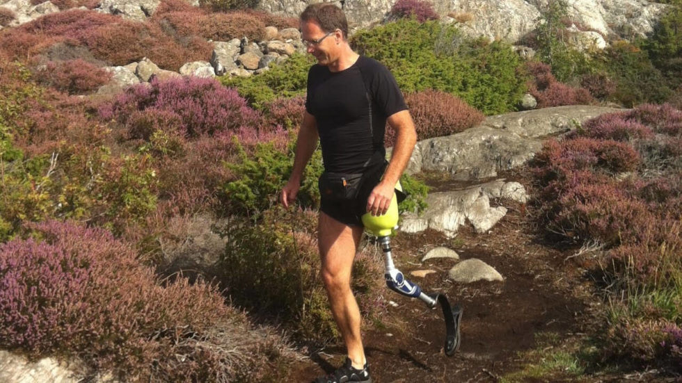 Above the Knee Prosthesis Alltech Prosthetics